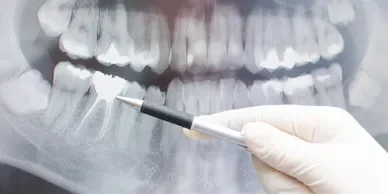 radiografía-ortodoncia-dientes