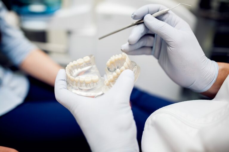 beneficios-implantes-dentales-barcelona