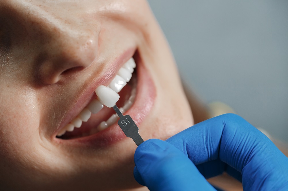 implantes-dentales-dolor-clinica