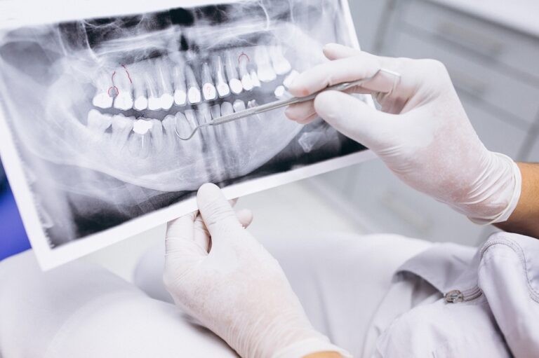 radiografia-de-dientes-edentulismo